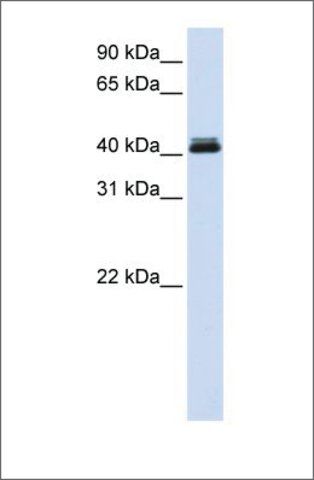 Anti-CANT1 antibody produced in rabbit