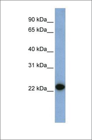 Anti-CAV1 antibody produced in rabbit