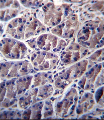 ANTI-CAPN8 (CENTER) antibody produced in rabbit