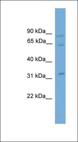 Anti-CAPN11 antibody produced in rabbit