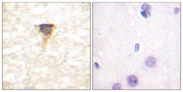 Anti-CAMK4 antibody produced in rabbit