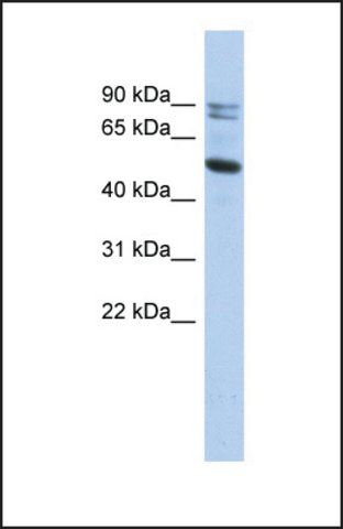 Anti-CAPN10, (N-terminal) antibody produced in rabbit