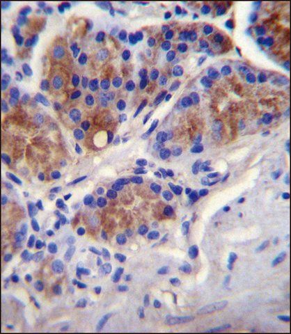 ANTI-CASP12 (CENTER) antibody produced in rabbit