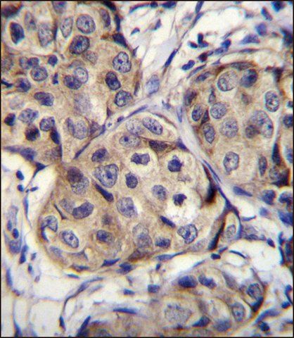 ANTI-CBLN2 (C-TERM) antibody produced in rabbit