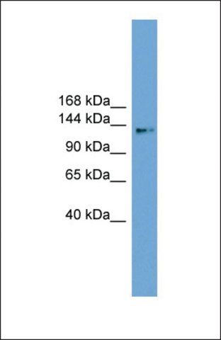 Anti-CCDC146 antibody produced in rabbit