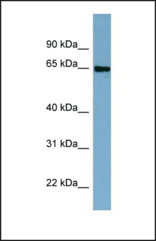 Anti-CBFA2T2 antibody produced in rabbit