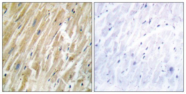 Anti-CALR antibody produced in rabbit