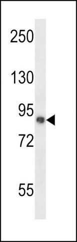 ANTI-CAPN11 (CENTER) antibody produced in rabbit