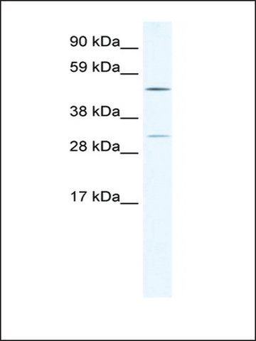 Anti-CAMK4 antibody produced in rabbit