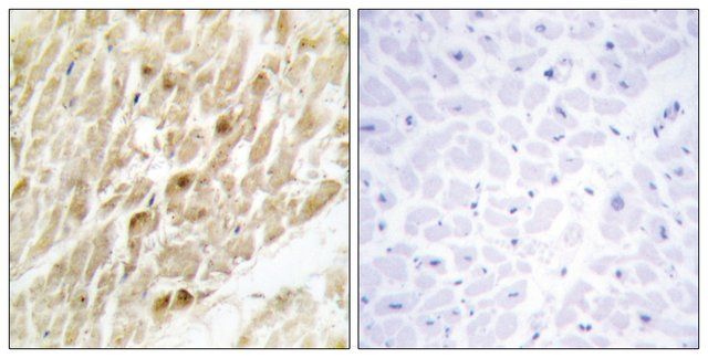 Anti-CBF  antibody produced in rabbit