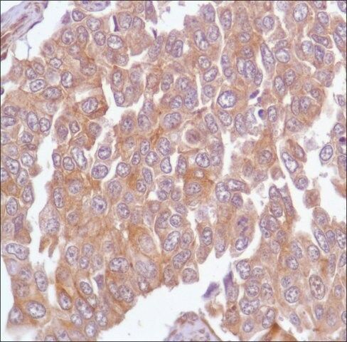 Anti-Calpain antibody, Rabbit monoclonal