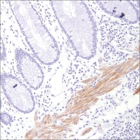 Anti-Calponin-1 antibody, Rabbit monoclonal