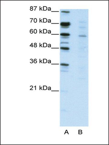 Anti-CBFA2T3 (AB2) antibody produced in rabbit