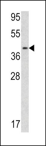 ANTI-CALPONIN-3 (CENTER) antibody produced in rabbit