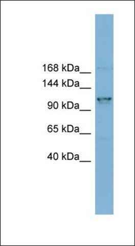 Anti-CCDC87 antibody produced in rabbit