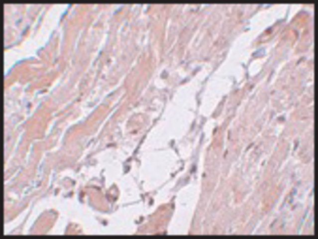 Anti-CCDC47 antibody produced in rabbit