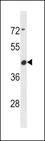 ANTI-CBWD6 (CENTER) antibody produced in rabbit