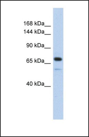 Anti-CALD1 antibody produced in rabbit