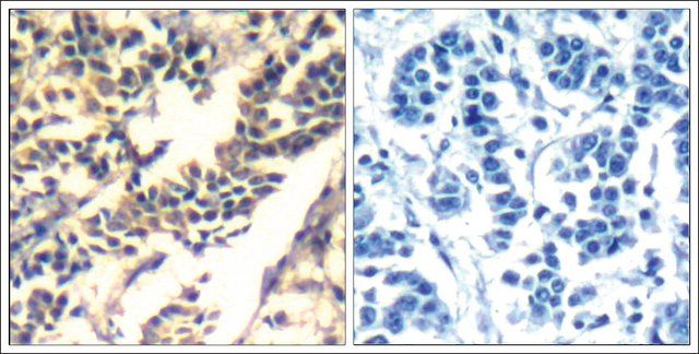 Anti-CBL (Ab-700) antibody produced in rabbit