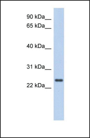 Anti-CCDC70 antibody produced in rabbit