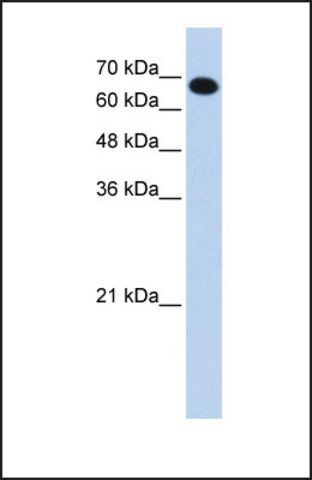 Anti-CCDC38, (N-terminal) antibody produced in rabbit