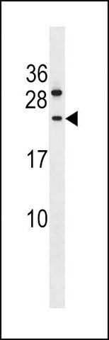 ANTI-CCDC140 (N-TERM) antibody produced in rabbit