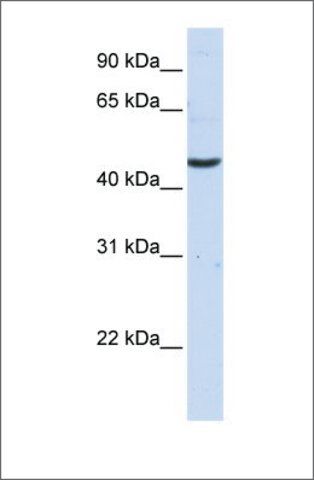 Anti-CCBL2 antibody produced in rabbit