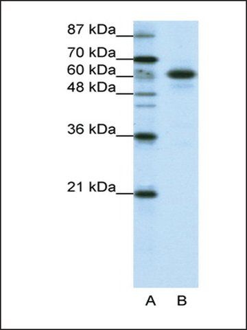 Anti-CBLL1 antibody produced in rabbit