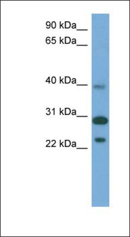 Anti-CCDC28A antibody produced in rabbit