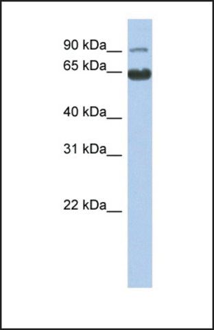 Anti-CCDC128, (N-terminal) antibody produced in rabbit