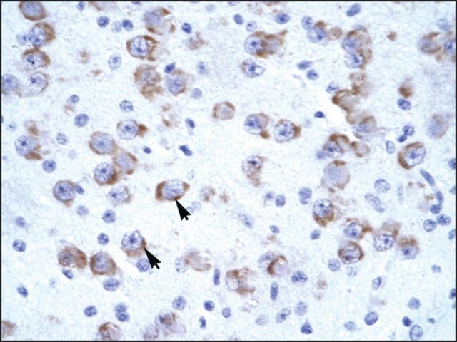 Anti-CATSPER2 (AB2) antibody produced in rabbit