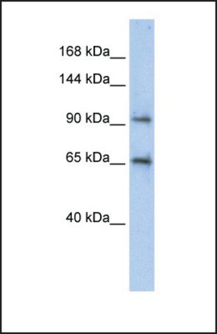 Anti-CCDC52 antibody produced in rabbit