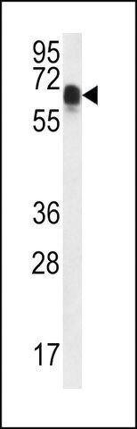 ANTI-CCDC102A(C-TERMINAL) antibody produced in rabbit