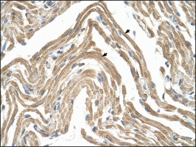 Anti-CCBP2 antibody produced in rabbit