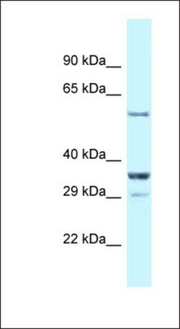 Anti-CBLL1 antibody produced in rabbit