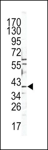 ANTI-CATB (CENTER) antibody produced in rabbit