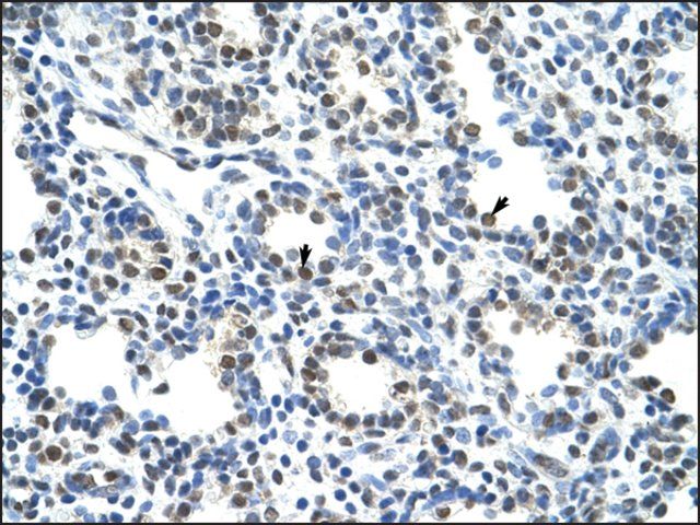 Anti-CBX3 antibody produced in rabbit