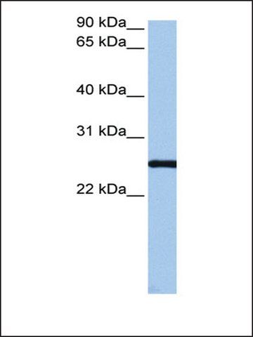 Anti-CCDC46 antibody produced in rabbit