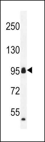 ANTI-CCDC110(C-TERMINAL) antibody produced in rabbit