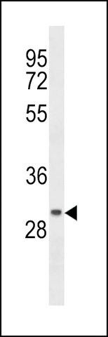 ANTI-CCDC24(N-TERMINAL) antibody produced in rabbit