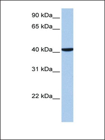 Anti-CC2D1B antibody produced in rabbit