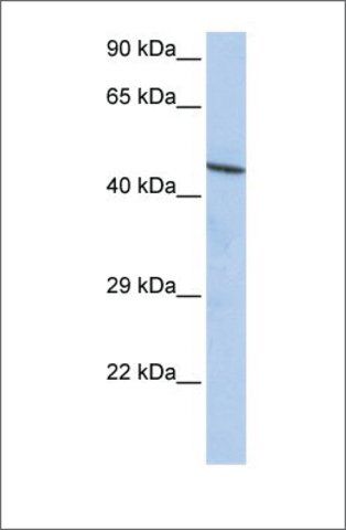 Anti-CCDC16 antibody produced in rabbit