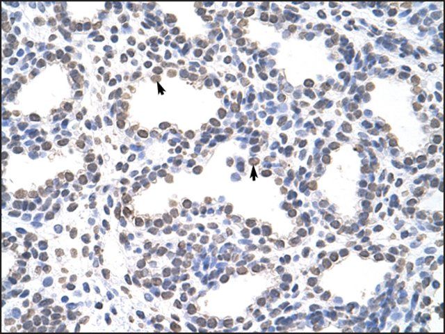 Anti-CARS (AB1) antibody produced in rabbit