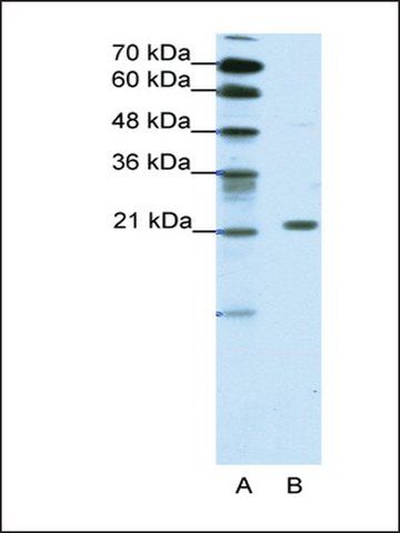 Anti-CBX1 antibody produced in rabbit