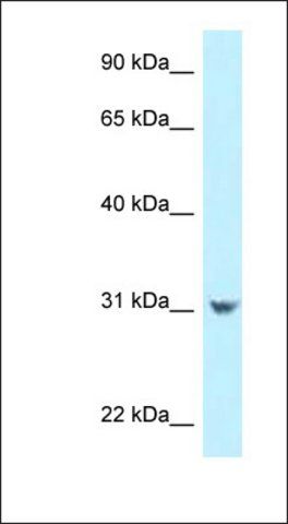 Anti-CCDC102B antibody produced in rabbit