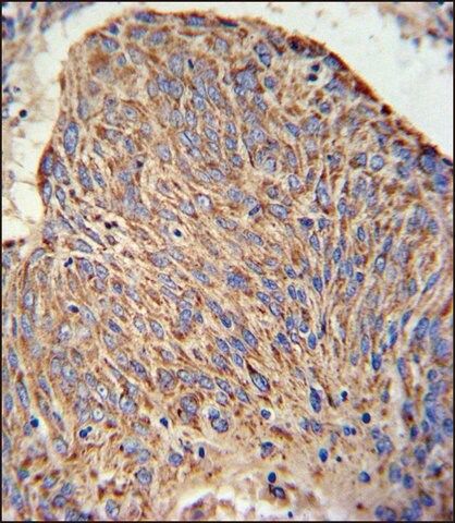 ANTI-CC130 (CENTER) antibody produced in rabbit