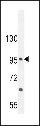 ANTI-CCDC39 (C-TERM) antibody produced in rabbit