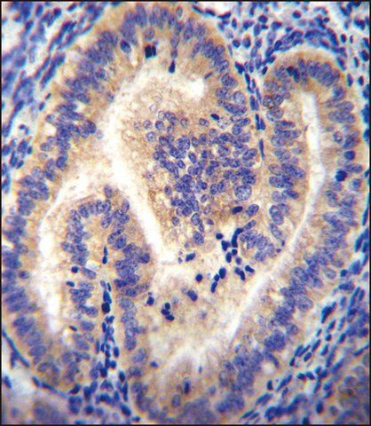 ANTI-CCDC54 (CENTER) antibody produced in rabbit