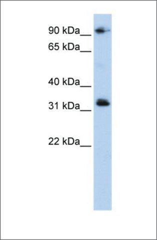 Anti-CCDC69 antibody produced in rabbit