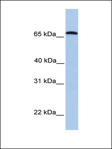 Anti-CCIN antibody produced in rabbit